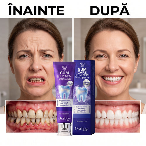 Pastă de Dinți Anticarie și pentru Gingii Sănătoase